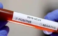 پادزهر ویروس مرگبار کرونا پیدا شد/ حقایقی جالب درباره پلاسمای خون بهبودیافتگان کرونا + فیلم