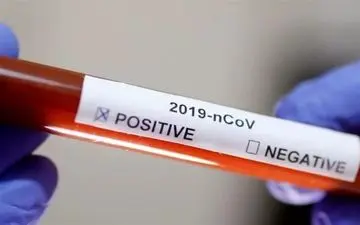 پادزهر ویروس مرگبار کرونا پیدا شد/ حقایقی جالب درباره پلاسمای خون بهبودیافتگان کرونا + فیلم