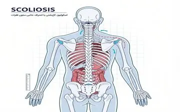 نقش دستگاه وزنه آزاد بدنسازی در اصلاح ناهنجاری‌های قامتی