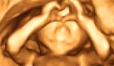 جنین درون شکم مادرش با ژستی جالب که به سوژه داغ بدل شد!+عکس