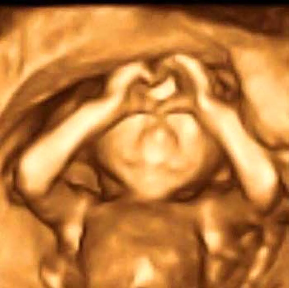 جنین درون شکم مادرش با ژستی جالب که به سوژه داغ بدل شد!+عکس