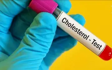 چقدر زمان می برد تا کلسترول پایین بیاید؟