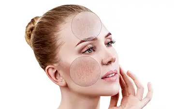 پوستی شاداب و جوان با ۶ راز مراقبت از پوست های مختلط
