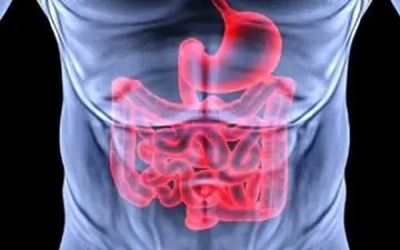  برای جلوگیری از سرطان روده چه سبزیجاتی بخوریم؟