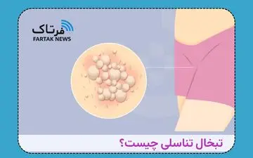 هشدار جدی؛ تبخال تناسلی؛ ویروسی که در خواب هم منتقل می‌شود!