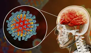 سکته مغزی ۲۵ بیمار مبتلا به ویروس کرونا در بیمارستان شهدای تجریش + فیلم