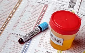 ۶ گام ساده خانگی برای از بین بردن علائم عفونت ادراری