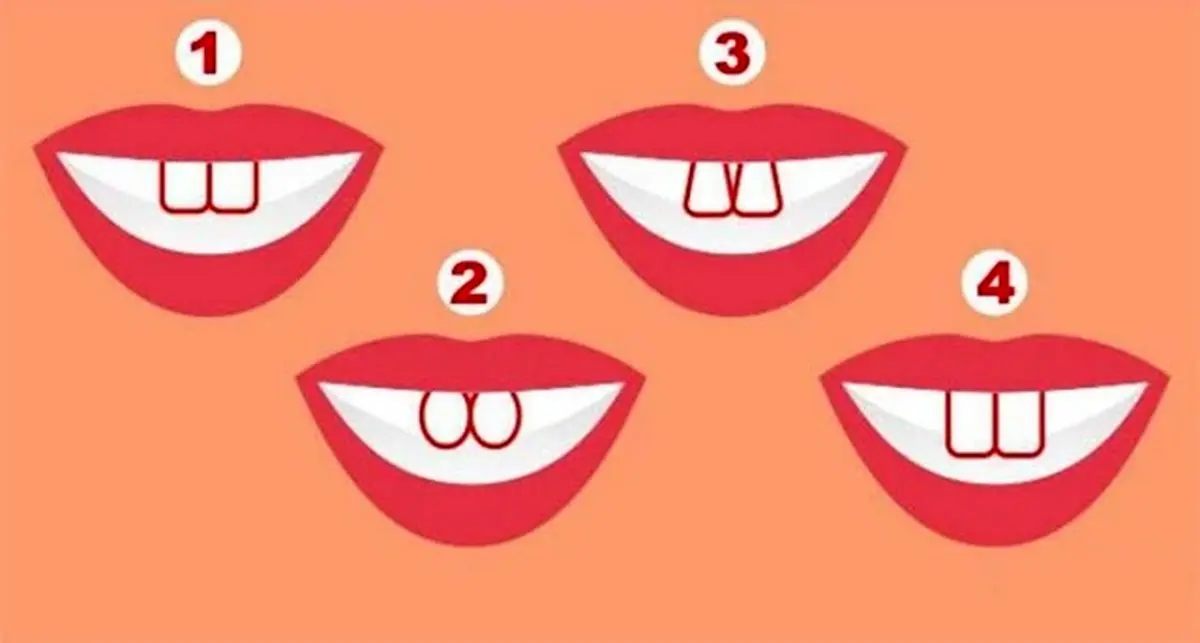 شخصیت شناسی جالب از روی فرم دندان شما