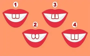 شخصیت شناسی جالب از روی فرم دندان شما