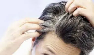 شناسایی ۶ مشکل سلامتی از ظاهر موی سر