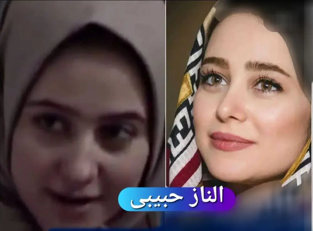 عکس بازیگران زن ایرانی قبل و بعد از عمل زیبایی