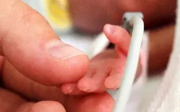 چه عوامل موثری در بروز زایمان زودرس تاثیر دارند؟