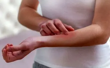 خارش پوست در نقاط مختلف بدن خبر از چه بیماری هایی می دهند؟ 