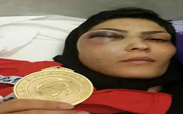 مسابقه با گونه‌ای شکسته فقط به خاطر راحتی مادر + فیلم