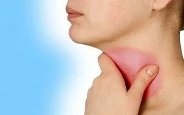 این علائم به شما می‌گوید کمبود یُد دارید