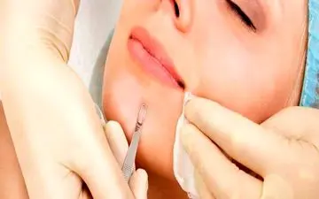 به این جوش ها هرگز دست نزنید