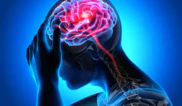 
علائم اصلی سکته مغزی چیست؟