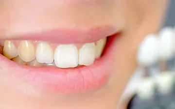 اگر دندان درد دارید این قرص را مصرف نکنید
