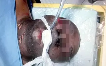 ماجرای خودسوزی قاتل جوان 29 ساله