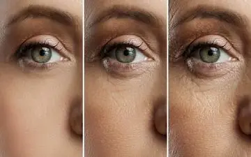 امیدهای تازه برای درمان پیرچشمی