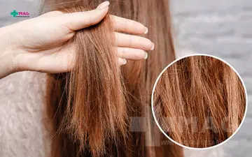 ناخن‌هات شکننده است؟ موی سرت می‌شکنه؟ بیا تا دلیلش رو بهت بگم!