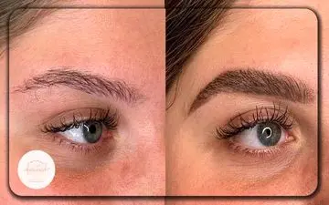 بهترین سن برای کاشت ابرو چه زمانی است؟ | بررسی علمی و پزشکی