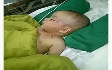 چرا کودک بی گناه به این روز افتاد؟