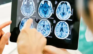 چه مواردی خطر ابتلا به عفونت مغزی را بالا می‌برد؟