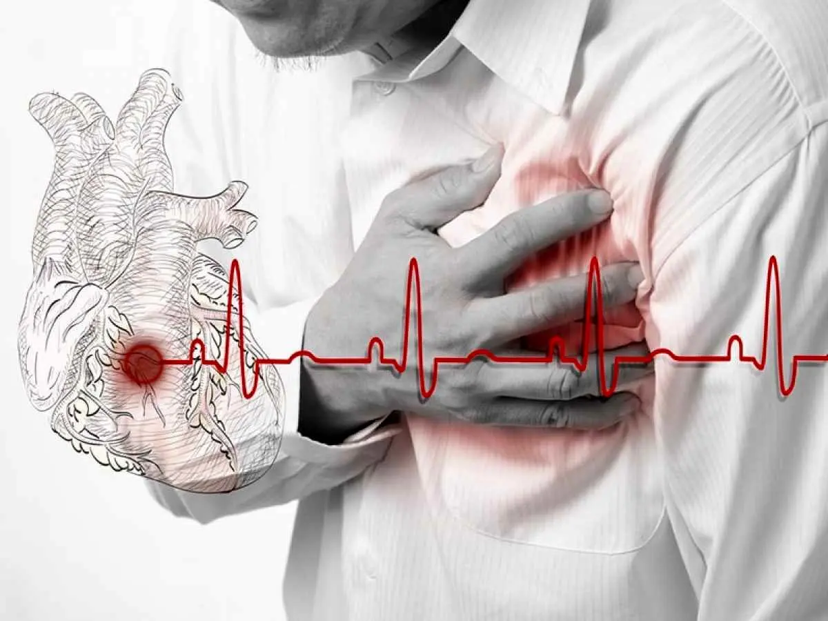 آیا سکته قلبی در فصل سرما بیشتر است؟