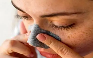 چند روش برای درمان جوش سر سیاه

