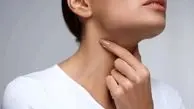 این غذاها برای گلودرد سم است