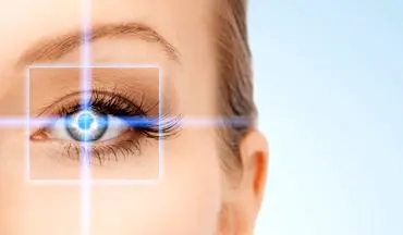 عوارض جانبی جراحی لیزری چشم