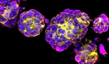ابداع نانوکریستال های سلولزی برای بهبود دارو رسانی و درمان سرطان