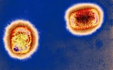 آخرین جزئیات از ویروس آبله میمون