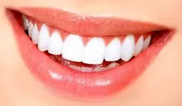 آب‌ های گازدار باعث تخریب مینای دندان می شود