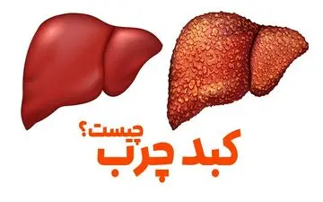 10 ماده غذایی که باید در رژیم کبد چرب گنجانده شود