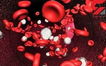 کمبود آهن را  چگونه بدون آزمایش  تشخیص دهیم؟