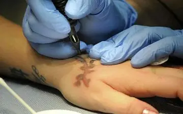 روش فوری پاک کردن تتو و خالکوبی در منزل + آموزش قدم به قدم