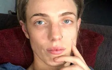 ابتلای پرستار جوان به ویروس کرونا با یک علامت بسیار عجیب 