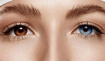 ترغیب مردم به انجام جراحی ممنوعه در خارج از کشور تخلف است