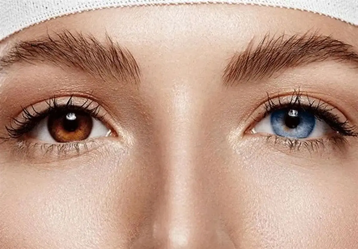 ترغیب مردم به انجام جراحی ممنوعه در خارج از کشور تخلف است