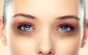 علت گودی و سیاهی زیر چشم در زنان چیست؟ سیاهی و گودی زیرچشم را با این خوراکی ها برطرف کنید