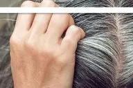 طب سنتی و علت سفیدی موها