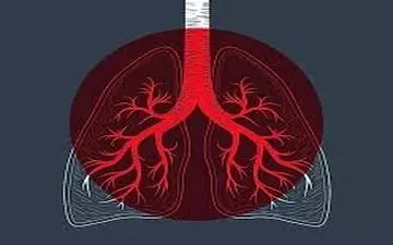 وضعیت زرد کرونایی برای قم