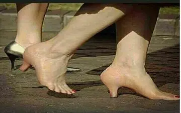 عجیب ترین و خنده دار ترین جراحی زیبایی یک زن در دنیا! +عکس 