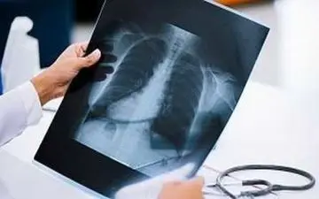 عکس قفسه سینه و تعیین طول عمر؟!|تعیین سن بیولوژیکی و طول عمر انسان با هوش مصنوعی
