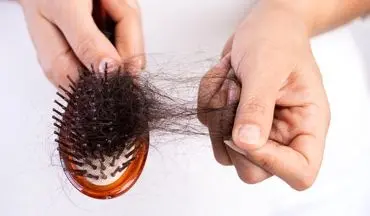 روشی سنتی برای جلوگیری از ریزش مو