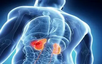  بیماری کلیوی ریسک این بیماری را افزایش می‌دهد