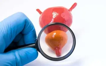 بزرگی پروستات در جوانان