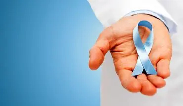 علل ابتلا به سرطان پروستات+ روش های درمان